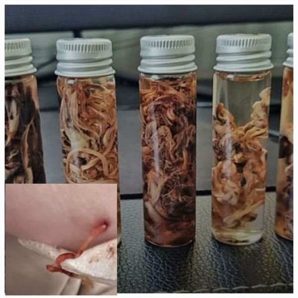 Zombie Apocalypse confirmed